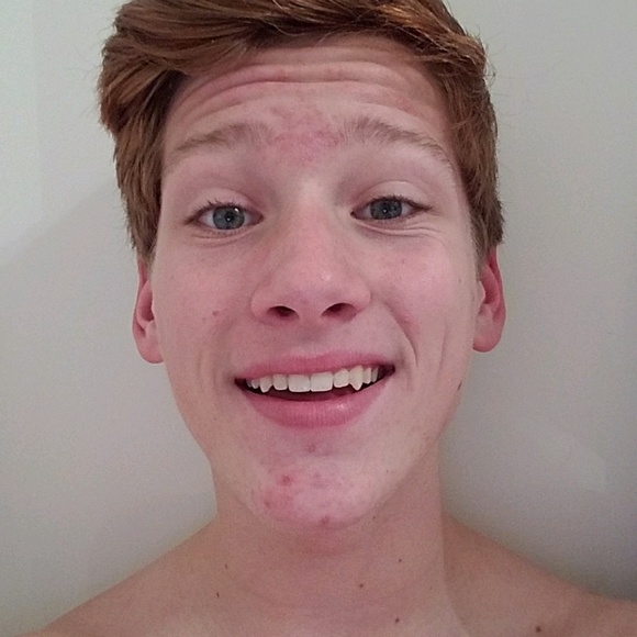 Meet your Posher, Quinn - Picture 1 of 1